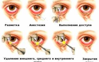Как при помощи косметологии убрать синяки под глазами