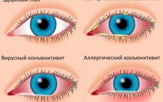 Рекомендации по применению глазных капель Накван