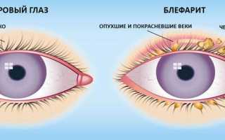 Применение и аналоги глазных капель Макситрол