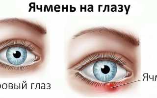Причины и методы лечения покраснений век у детей