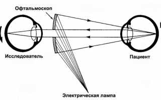 Особенности лечения ожогов глаз