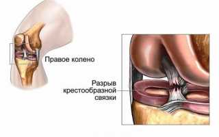 Травмы колена