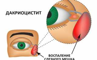 Можно ли детям при конъюнктивите гулять на улице