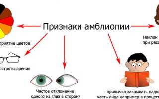 Особенности поликории — как видят люди с двойным зрачком