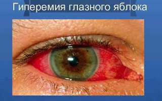 Применение капель для глаз Таурин взрослым