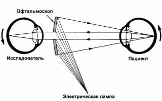 Лечение и профилактика хемоза конъюнктивы