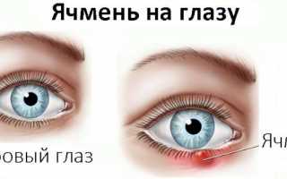 Применение Тетрациклиновой мази при лечении ячменя
