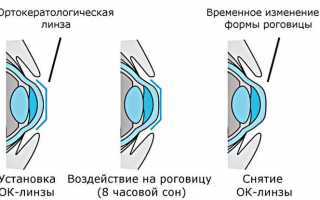 Как видит предметы человек с астигматизмом