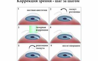 Чем отличаются Фемтоласик и Ласик