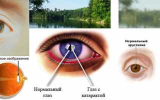 Устройство и функции хрусталика глаза