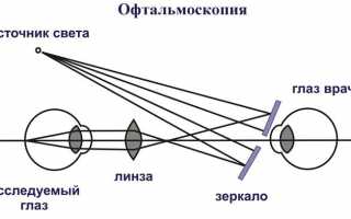 Причины дегенерации сетчатки
