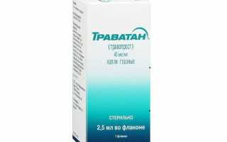 Применение аналогов Дорзопта при развитии глаукомы