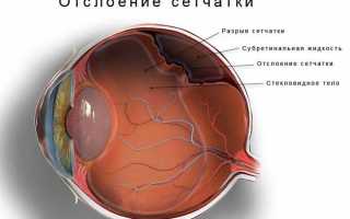 Причины инъецированности склер
