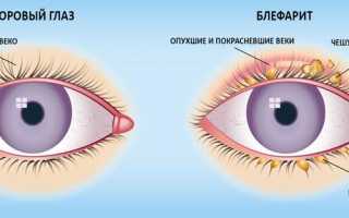 Инструкция по использованию японских глазных капель Santen