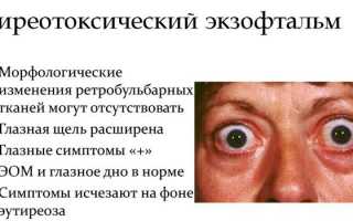 Причины экзофтальма, симптомы, лечение и профилактика