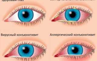 От чего может испортиться зрение – главные факторы