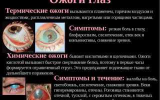 Последствия и лечение химического ожога глаз