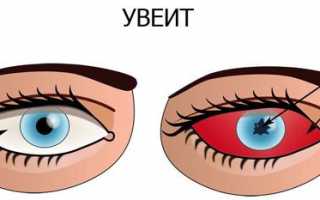Свойства и применение глазной мази Тобрадекс