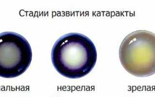Лечение и удаление катаракты у пожилых людей