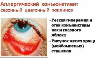 Особенности лечения аллергического конъюнктивита у ребёнка