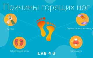 По каким причинам горят стопы ног
