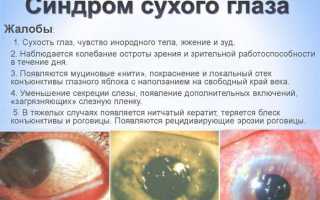 Применение глазных капель Оптив при сухости и дискомфорте