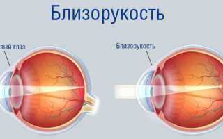 Эффективные методики гимнастики для глаз