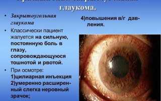 Применение капель Мидримакс для диагностики заболеваний глаз