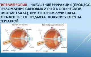 Применение глазных капель Дорзопт Плюс для снижения внутриглазного давления