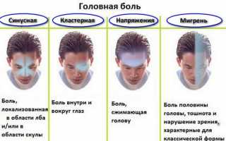 Почему болит голова и глаз с одной стороны