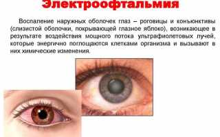 Лечение ожога глаз от сварки