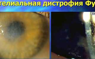 Строение и функциональное назначение цилиарного тела глаза