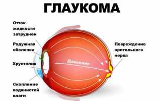 Строение и болезни передней камеры глаза