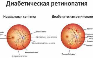 Витаминный комплекс для глаз Vitrum Vision Forte