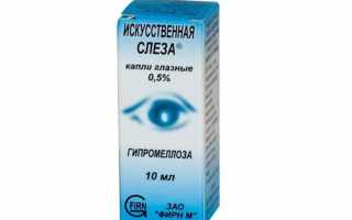 Лечение отёка глаз при аллергии