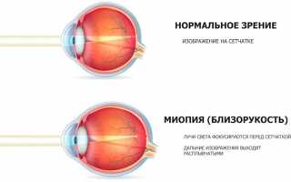 Выбор очков для зрения