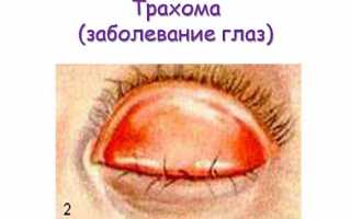 Эффективная терапия трахомы глаз