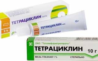 Как заложить Тетрациклиновую мазь за веко