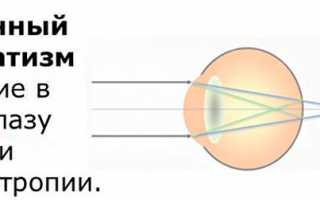 Причины развития и методы коррекции близорукости и дальнозоркости