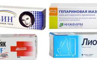 Причины синяков под глазами и способы избавления от дефекта