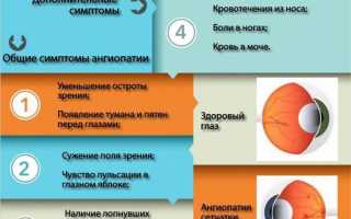 Инструкция по применению капель для глаз Тауфон