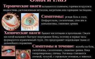 Лечение и последствия ожога роговицы глаза