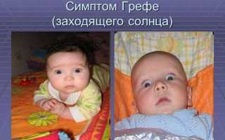 Почему новорождённый закатывает глаза