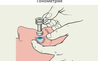 Истончение сетчатки глаза — причины и лечение
