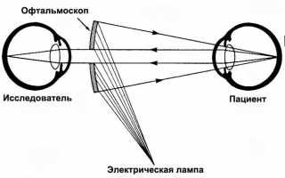 Причины и лечение расширенных зрачков у подростков