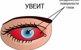Когда применяется артифакия глаза, возможные осложнения