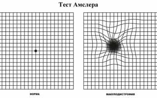 Как проверяют зрение у взрослых и детей с помощью таблиц