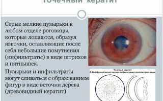 Правила применения глазных капель Униклофен