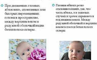 Почему дети закатывают глаза
