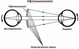 Что входит в оптическую систему глаза — функции и заболевания